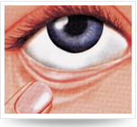 頭仰后，用食指將下眼瞼下拉，使其成袋狀