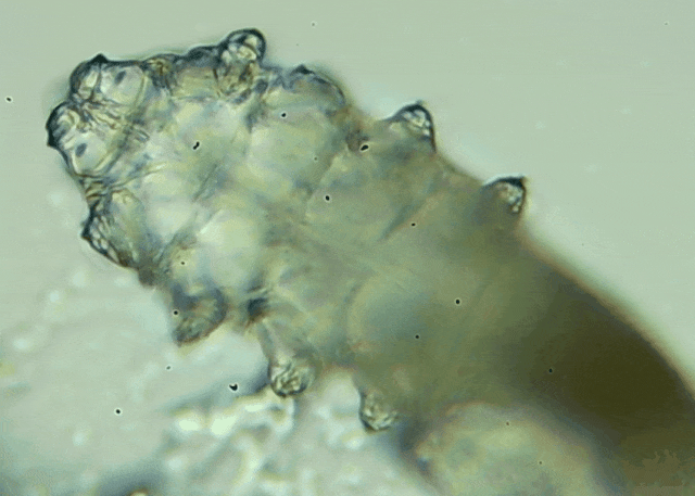 睫毛上驚現(xiàn)80只螨蟲(chóng)！別揉了，快自查下你的眼睛有沒(méi)有......