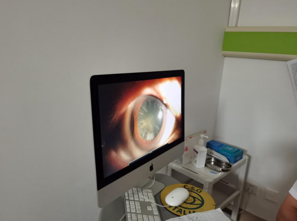 白內(nèi)障手術